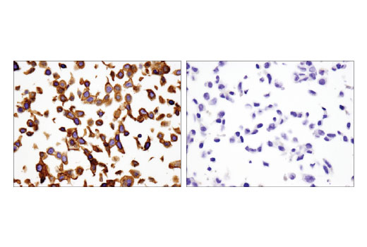 Immunohistochemistry Image 2: Integrin β4 (D8P6C) XP® Rabbit mAb