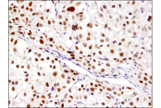 Immunohistochemistry Image 2: PROX1 (D2J6J) Rabbit mAb