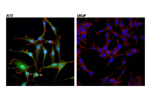  Image 20: Microglia Interferon-Related Module Antibody Sampler Kit