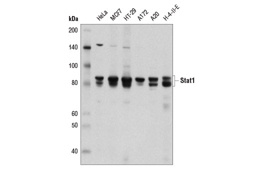  Image 19: IFN (Type I/III) Signaling Pathway Antibody Sampler Kit