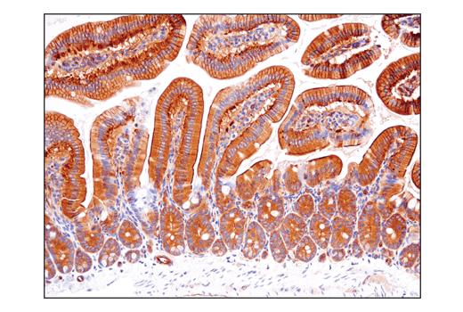 Immunohistochemistry Image 4: α-Actinin 4 (D7U5A) Rabbit mAb 