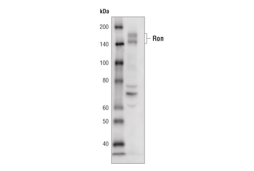 Western Blotting Image 1: Ron (C81H9) Rabbit mAb (Biotinylated)