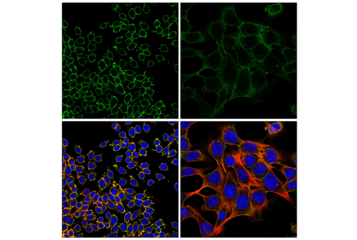 Immunofluorescence Image 3: Crry (E9M7T) Rabbit mAb