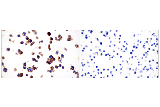 Immunohistochemistry Image 5: B7-H4 (D1M8I) XP® Rabbit mAb (BSA and Azide Free)