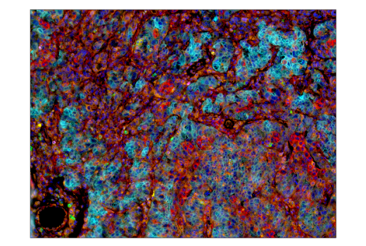 Immunohistochemistry Image 3: B7-H4 (D1M8I) XP® Rabbit mAb (BSA and Azide Free)