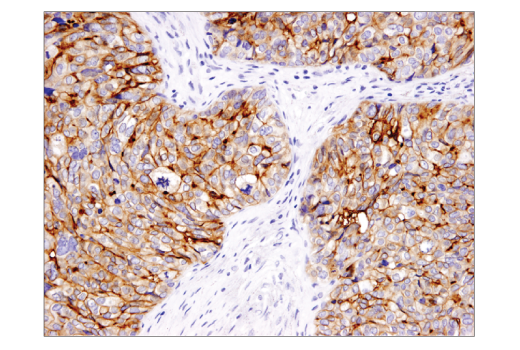 Immunohistochemistry Image 2: B7-H4 (D1M8I) XP® Rabbit mAb (BSA and Azide Free)