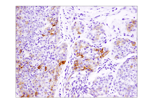 Immunohistochemistry Image 6: B7-H4 (D1M8I) XP® Rabbit mAb (BSA and Azide Free)