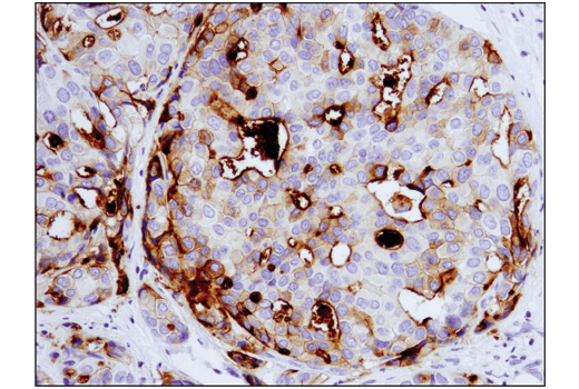 Immunohistochemistry Image 1: B7-H4 (D1M8I) XP® Rabbit mAb (BSA and Azide Free)