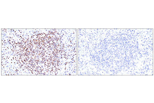 Immunohistochemistry Image 8: RUNX3/AML2 (E8D5W) XP® Rabbit mAb