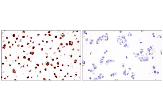 Immunohistochemistry Image 9: RUNX3/AML2 (E8D5W) XP® Rabbit mAb