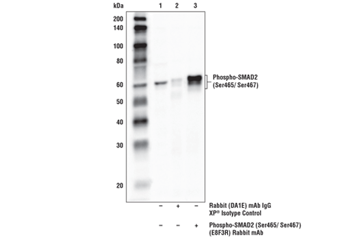  Image 13: TGF-β Fibrosis Pathway Antibody Sampler Kit