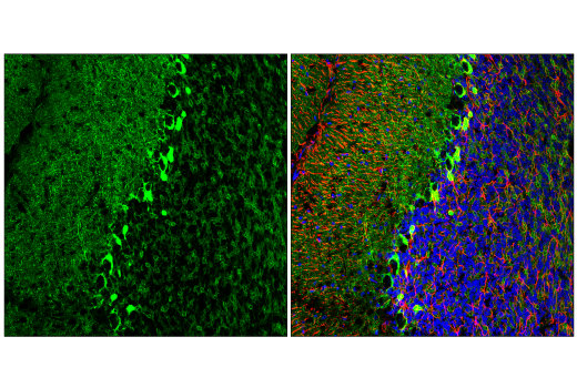 Immunofluorescence Image 1: GAT1 (E7J1B) Rabbit mAb (Alexa Fluor® 488 Conjugate)