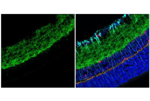 Immunofluorescence Image 2: GAT1 (E7J1B) Rabbit mAb (Alexa Fluor® 488 Conjugate)