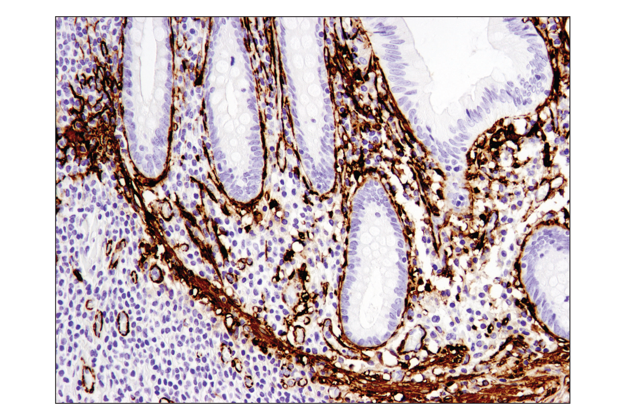  Image 15: TGF-β Fibrosis Pathway Antibody Sampler Kit