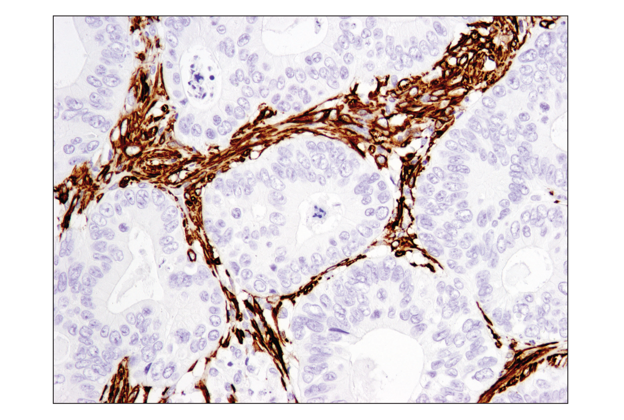  Image 29: TGF-β Fibrosis Pathway Antibody Sampler Kit