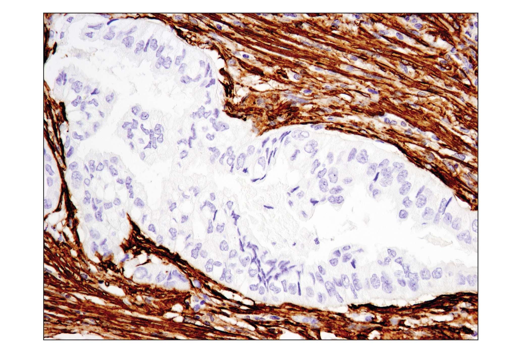  Image 34: TGF-β Fibrosis Pathway Antibody Sampler Kit