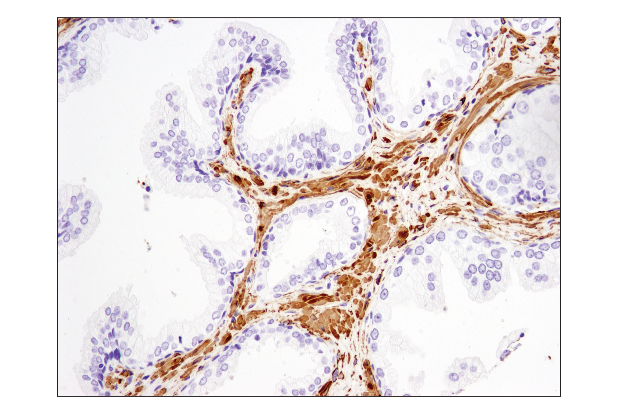  Image 36: TGF-β Fibrosis Pathway Antibody Sampler Kit