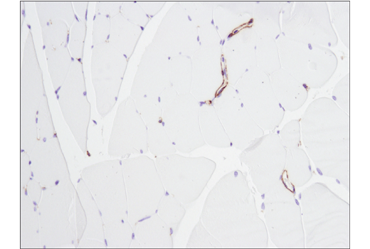  Image 43: Cancer Associated Fibroblast Marker Antibody Sampler Kit