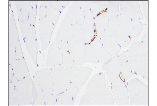 Immunohistochemistry Image 8: α-Smooth Muscle Actin (D4K9N) XP® Rabbit mAb