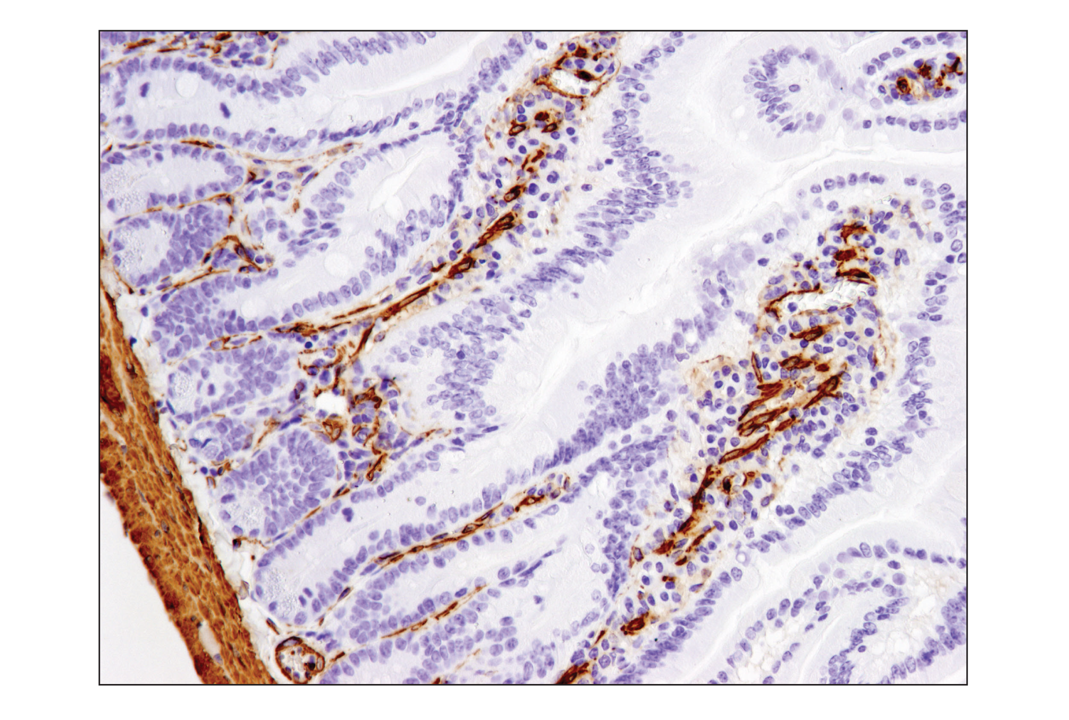  Image 40: TGF-β Fibrosis Pathway Antibody Sampler Kit
