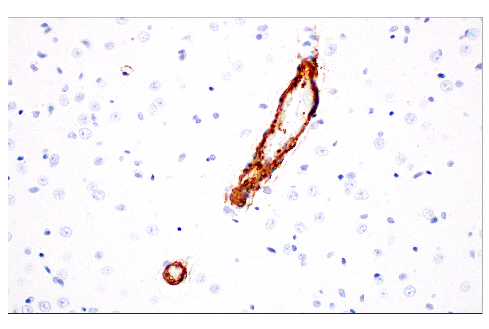  Image 54: Cancer Associated Fibroblast Marker Antibody Sampler Kit