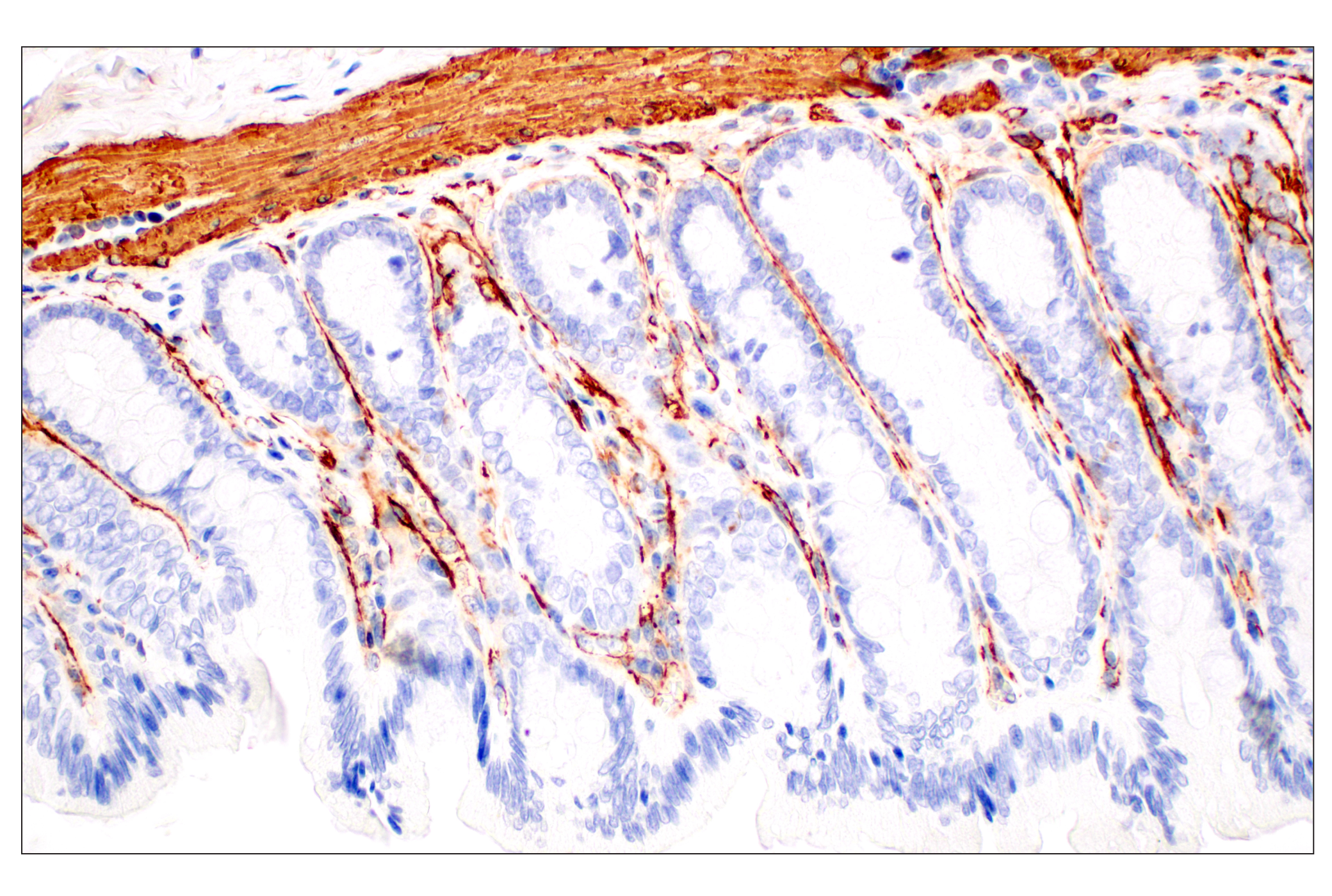  Image 47: TGF-β Fibrosis Pathway Antibody Sampler Kit