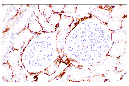  Image 44: TGF-β Fibrosis Pathway Antibody Sampler Kit