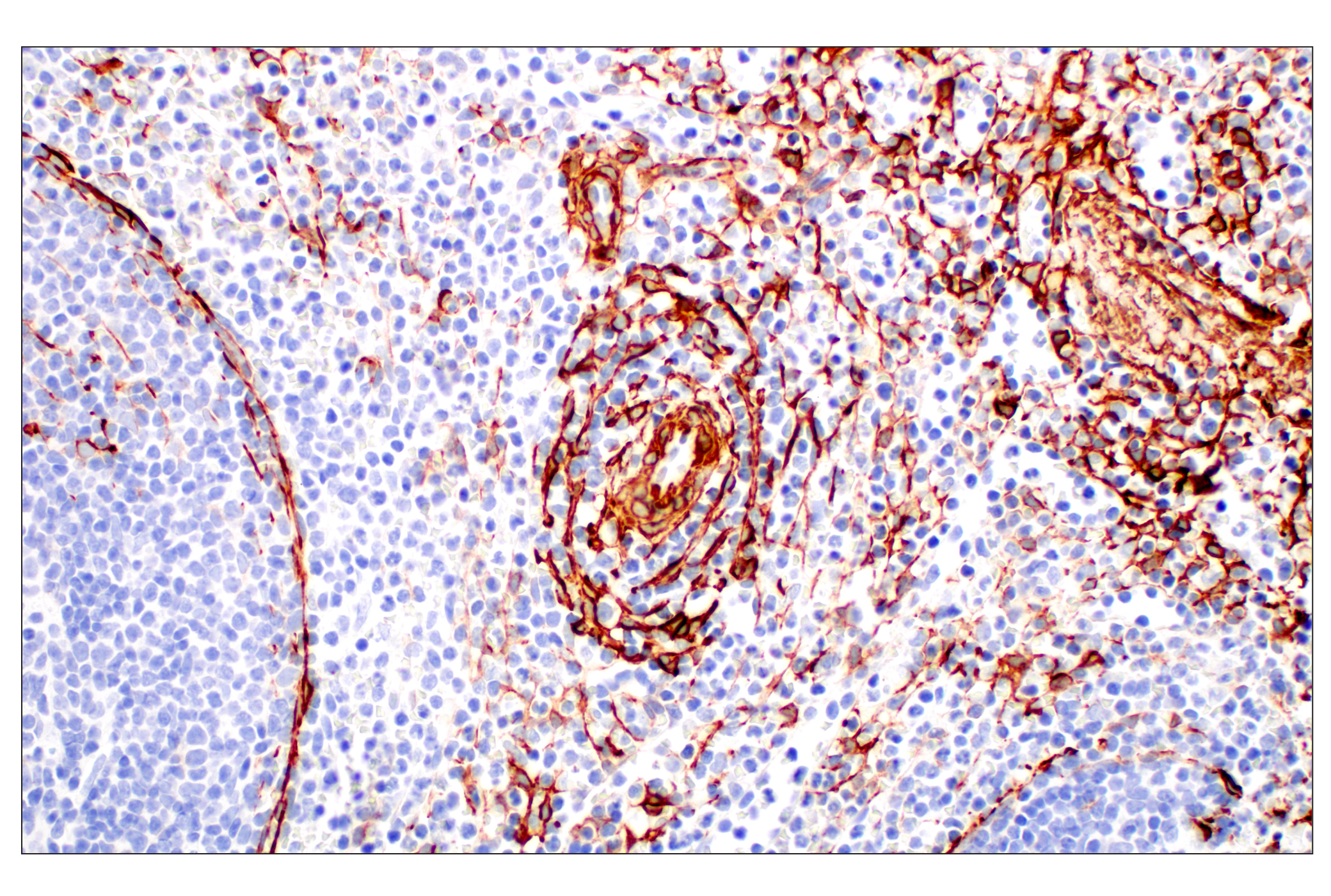  Image 45: TGF-β Fibrosis Pathway Antibody Sampler Kit