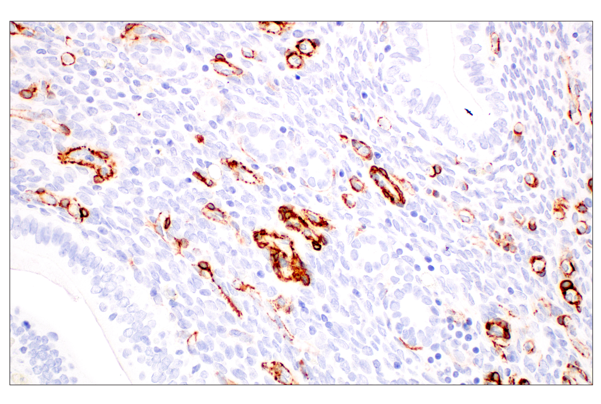 Image 56: Cancer Associated Fibroblast Marker Antibody Sampler Kit