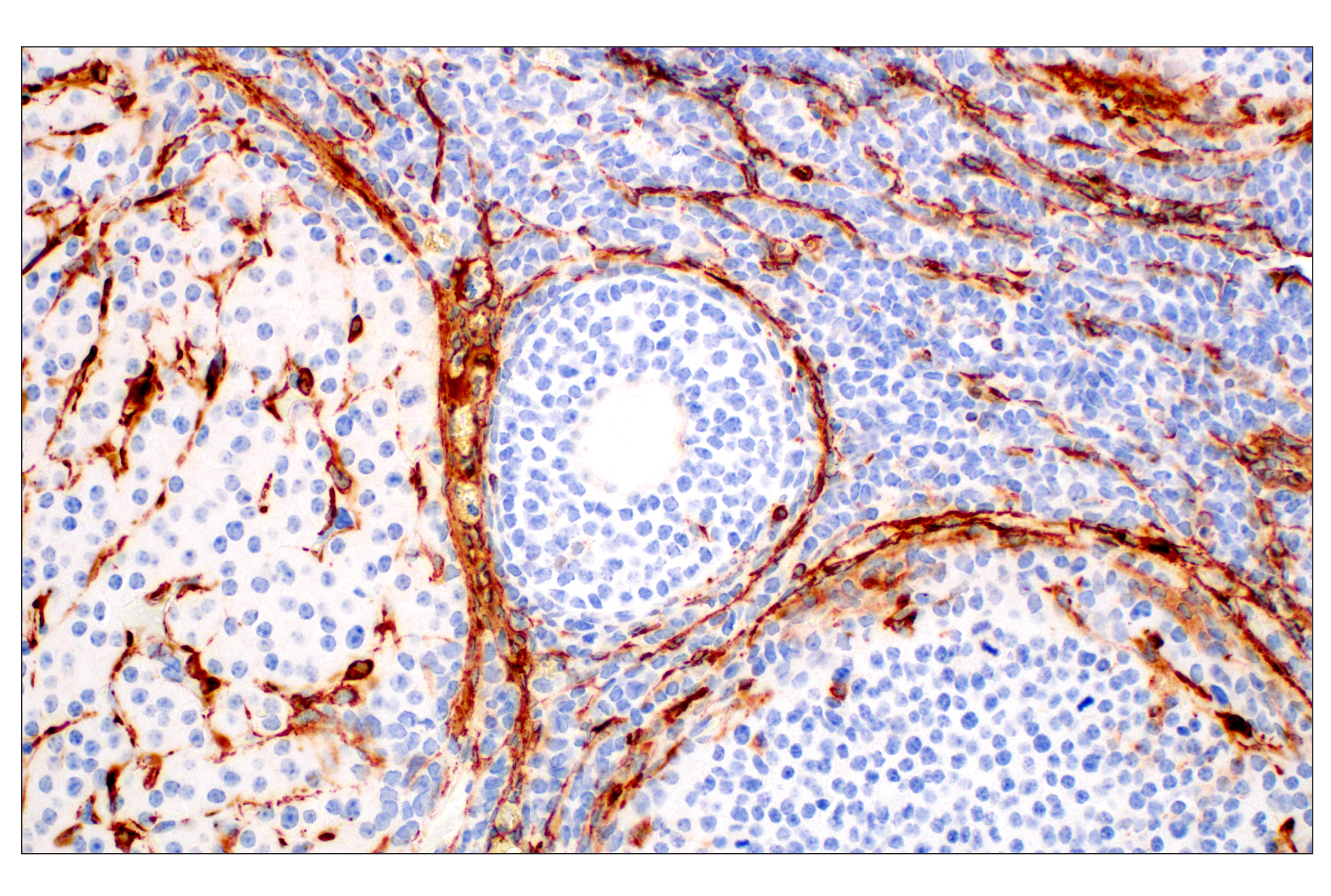  Image 49: TGF-β Fibrosis Pathway Antibody Sampler Kit