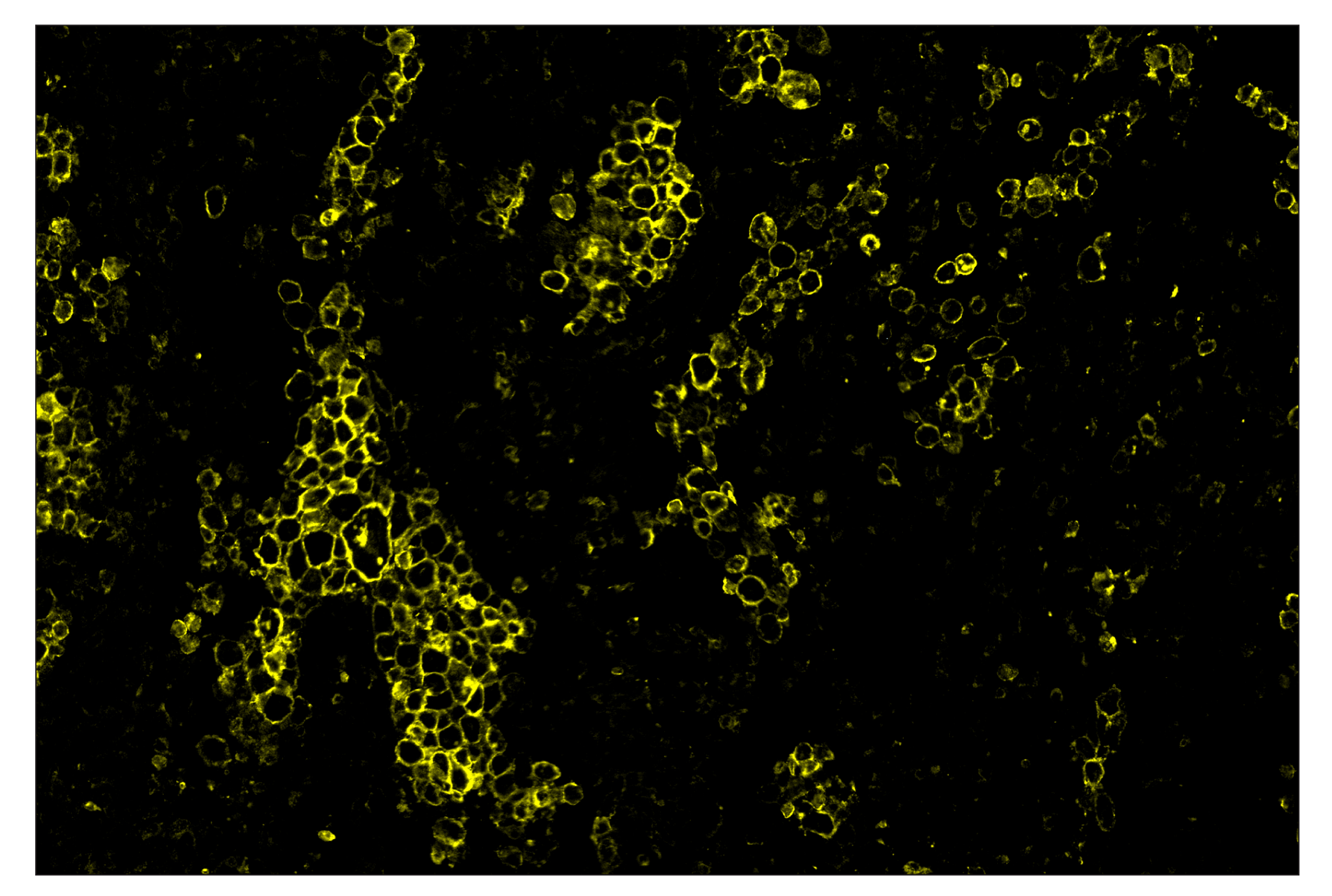 Immunohistochemistry Image 3: CD86 (E2G8P) & CO-0038-750 SignalStar™ Oligo-Antibody Pair