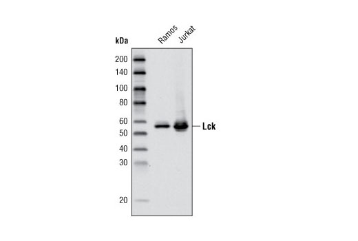 Western Blotting Image 1: Lck (D88) XP® Rabbit mAb (BSA and Azide Free)