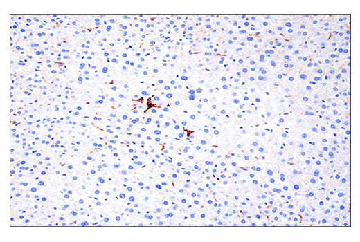  Image 14: Mouse Reactive M1 vs M2 Macrophage IHC Antibody Sampler Kit