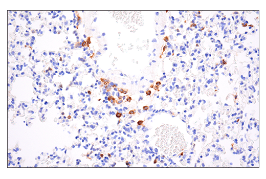  Image 21: Mouse Reactive M1 vs M2 Macrophage IHC Antibody Sampler Kit