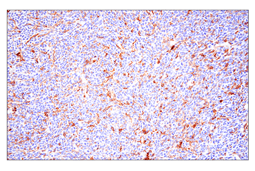 Immunohistochemistry Image 3: CD86 (E5W6H) Rabbit mAb