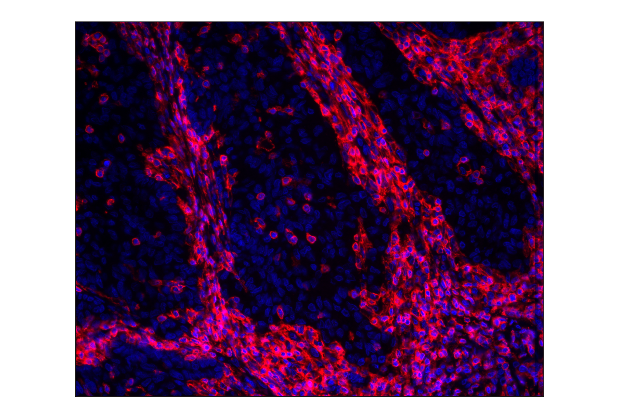 Immunohistochemistry Image 1: CD45 (Intracellular Domain) (D9M8I) XP® Rabbit mAb (Alexa Fluor® 647 Conjugate)