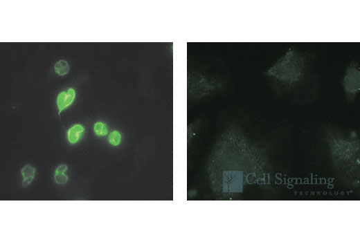  Image 14: Microglia LPS-Related Module Antibody Sampler Kit