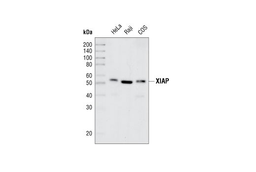 Western Blotting Image 1: XIAP (3B6) Rabbit mAb