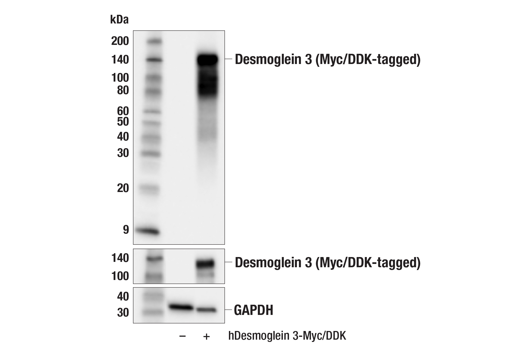 Western Blotting Image 1: Desmoglein 3 (5G11) Mouse mAb