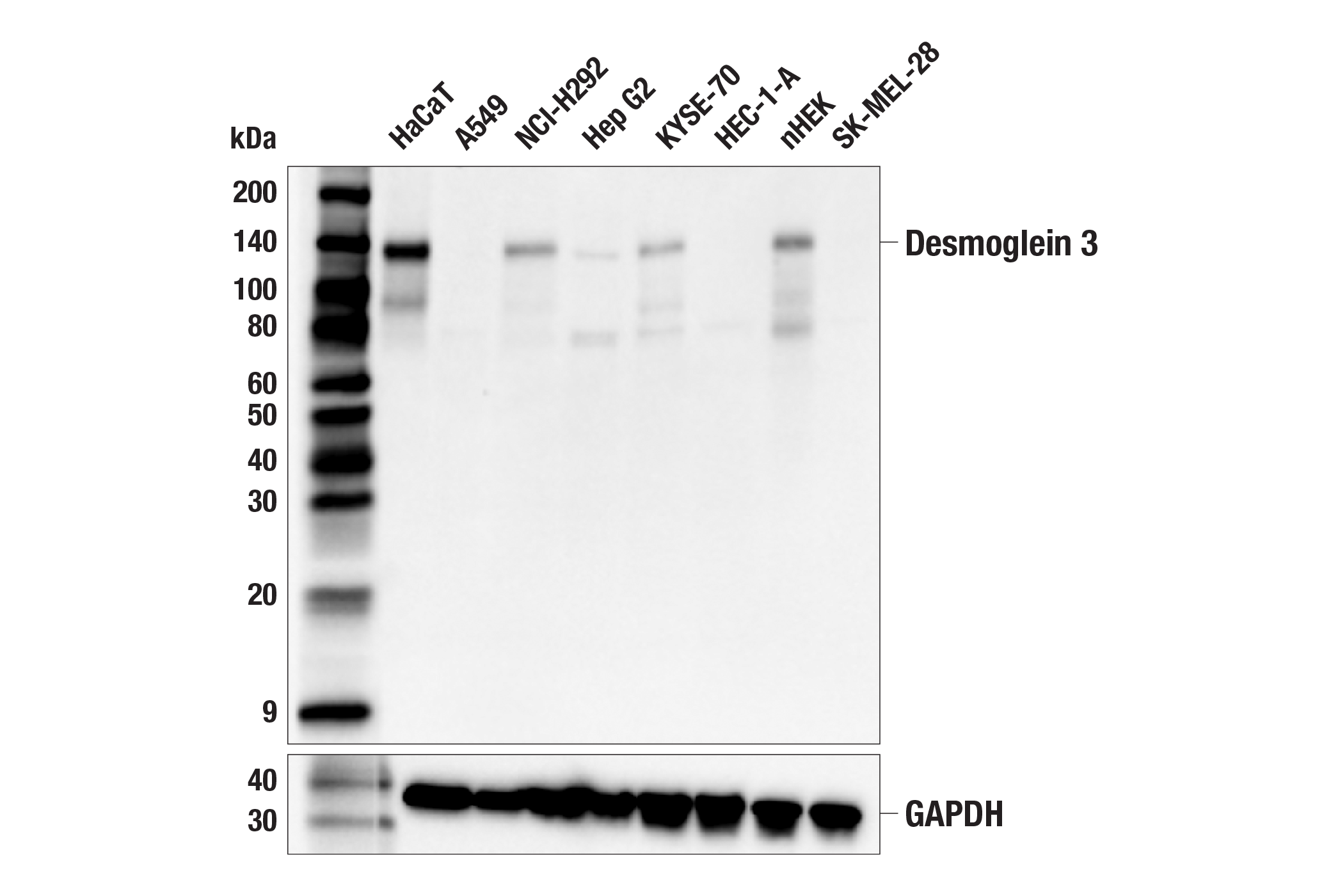 Western Blotting Image 2: Desmoglein 3 (5G11) Mouse mAb