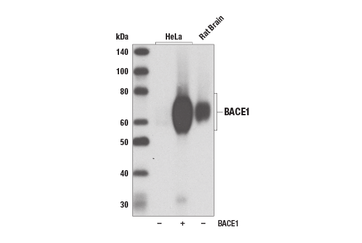 Western Blotting Image 1: BACE1 (D10E5) Rabbit mAb (BSA and Azide Free)