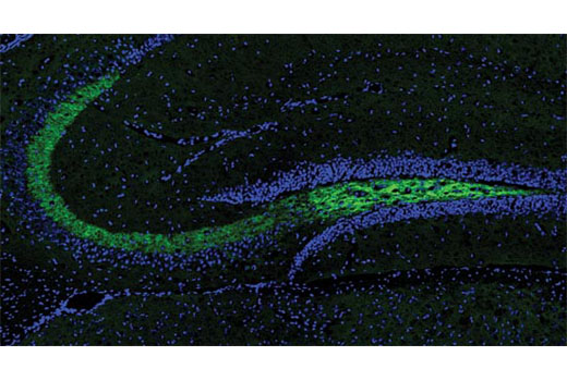 Immunofluorescence Image 1: BACE1 (D10E5) Rabbit mAb (BSA and Azide Free)