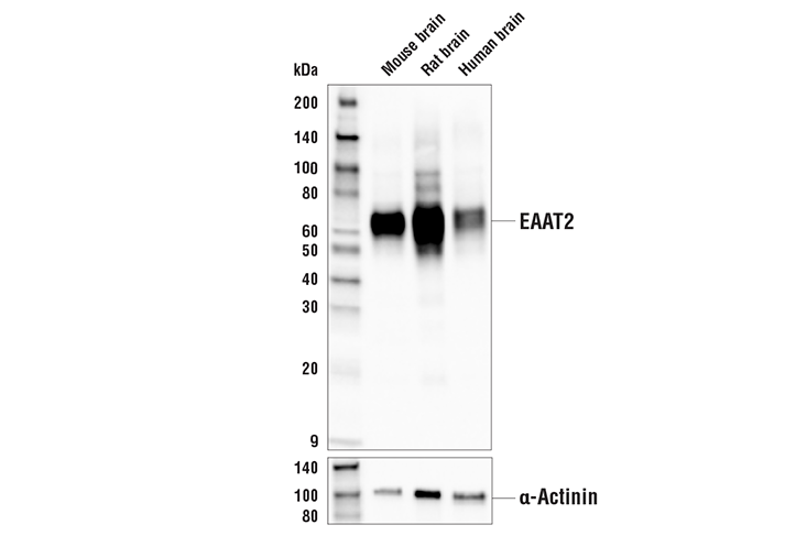  Image 5: Astrocyte Markers Antibody Sampler Kit