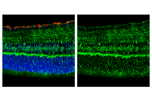 Immunofluorescence Image 1: EAAT2 (E3P5K) Rabbit mAb