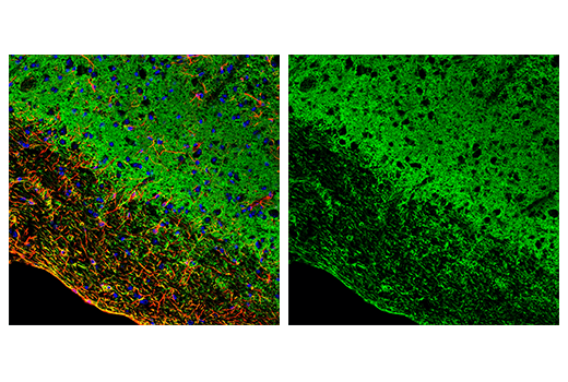  Image 20: Astrocyte Markers Antibody Sampler Kit