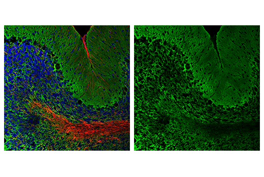  Image 25: Astrocyte Markers Antibody Sampler Kit