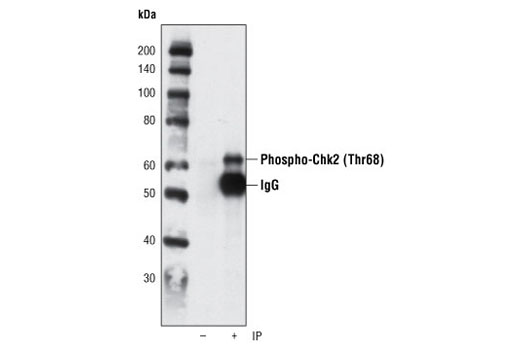  Image 13: Cell Cycle/Checkpoint Antibody Sampler Kit