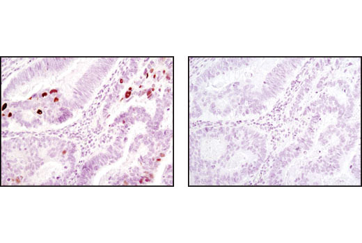  Image 22: Cell Cycle/Checkpoint Antibody Sampler Kit
