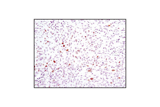 Immunohistochemistry Image 3: Phospho-Chk2 (Thr68) (C13C1) Rabbit mAb