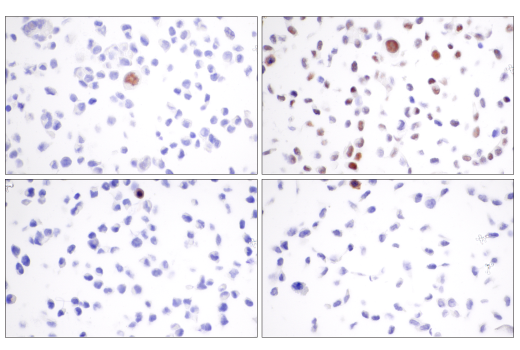  Image 33: Cell Cycle/Checkpoint Antibody Sampler Kit